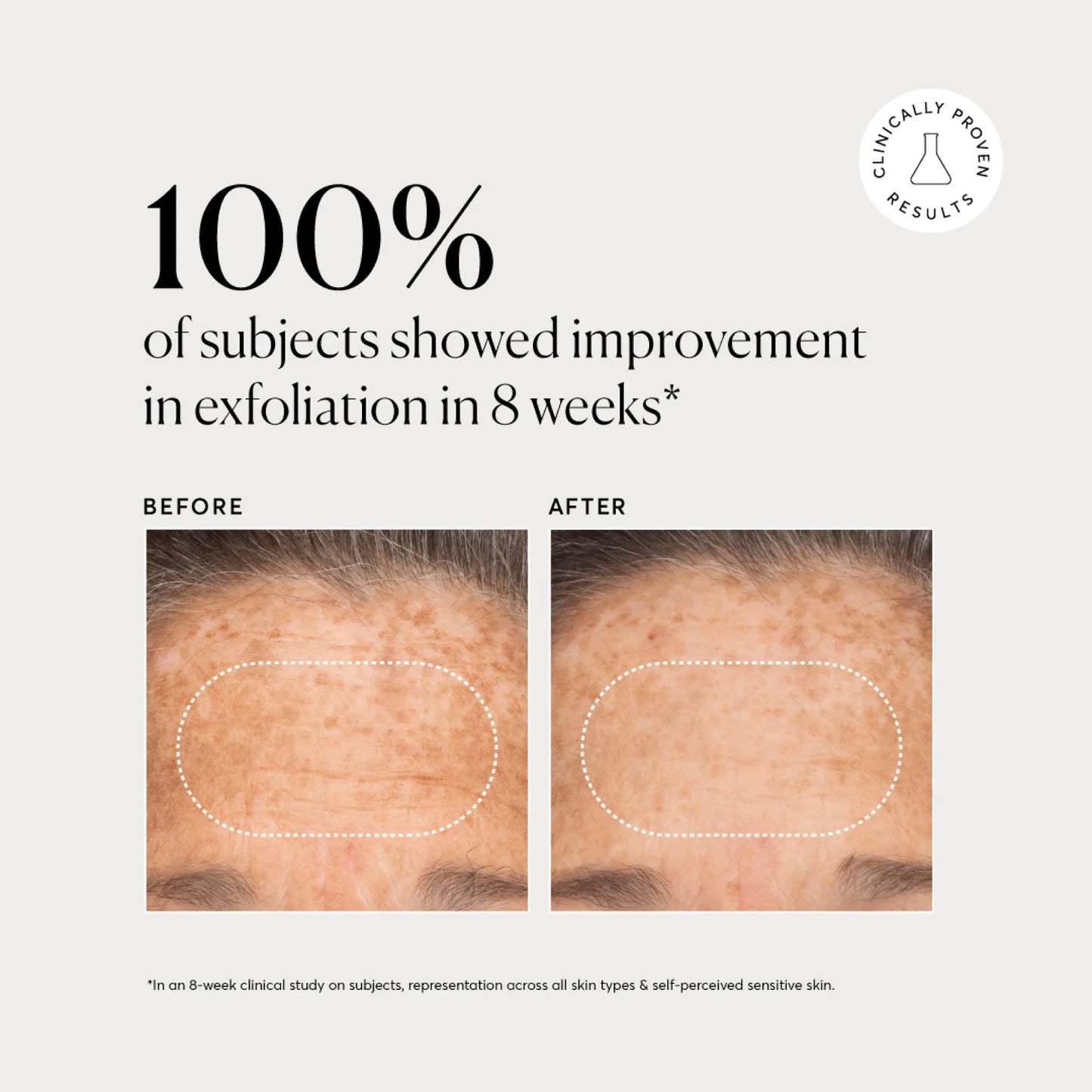 bha-liquid-exfoliant-2-f6 NATR-10027-Alt-Images-BHA-Liquid-Exfoliant-2_-03.webp